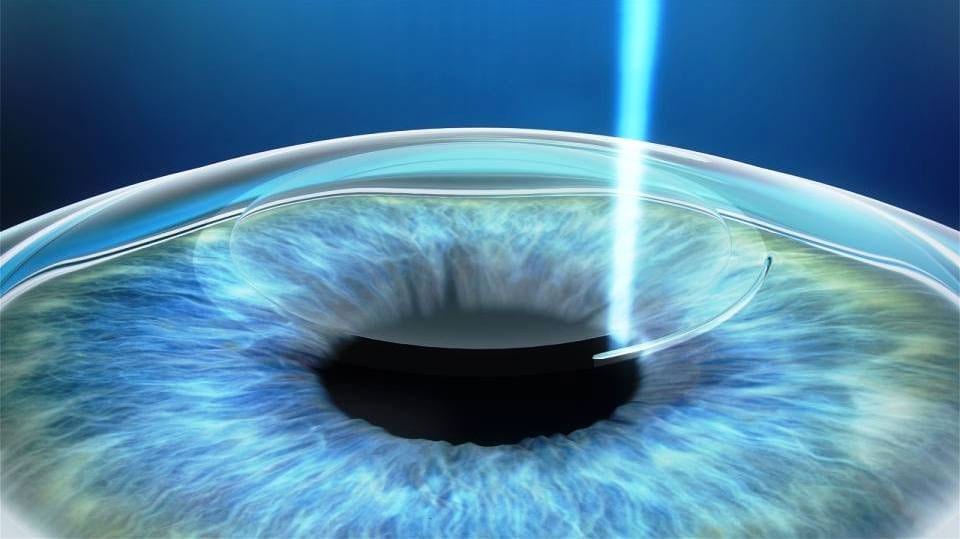 Cirurgia Refrativa RJ